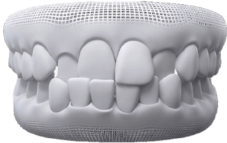 Dra Nicolle Paulucci, Invisalign Campo Grande, Protocolo completo Dra Nicolle Paulucci, Invisalign Campo Grande, Protocolo completo