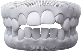 Dra Nicolle Paulucci, Invisalign Campo Grande, Protocolo completo Dra Nicolle Paulucci, Invisalign Campo Grande, Protocolo completo