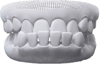 Dra Nicolle Paulucci, Invisalign Campo Grande, Protocolo completo Dra Nicolle Paulucci, Invisalign Campo Grande, Protocolo completo
