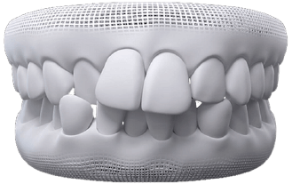Dra Nicolle Paulucci, Invisalign Campo Grande, Protocolo completo Dra Nicolle Paulucci, Invisalign Campo Grande, Protocolo completo