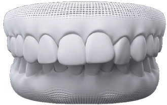 Dra Nicolle Paulucci, Invisalign Campo Grande, Protocolo completo Dra Nicolle Paulucci, Invisalign Campo Grande, Protocolo completo
